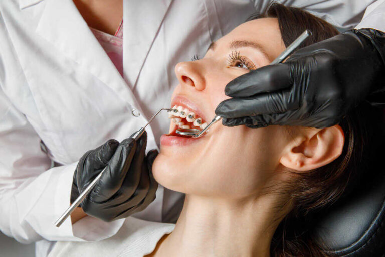 Kobieta zakłada aparat ortodontyczny